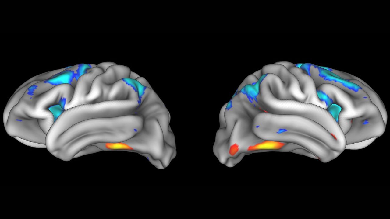 Neuroscience findings often can't be replicated ‪—‬ and it's a big problem for what we know about the brain